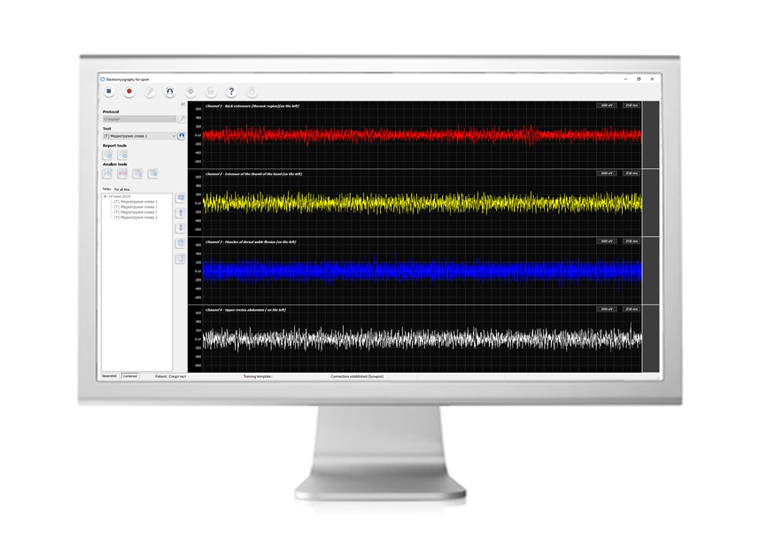 Нейрофизиологические основы метода: электромиография